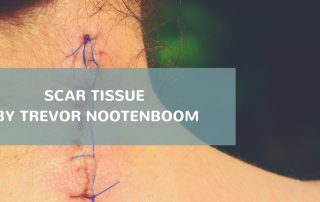 Scar Tissue Article Trevor Nootenboom