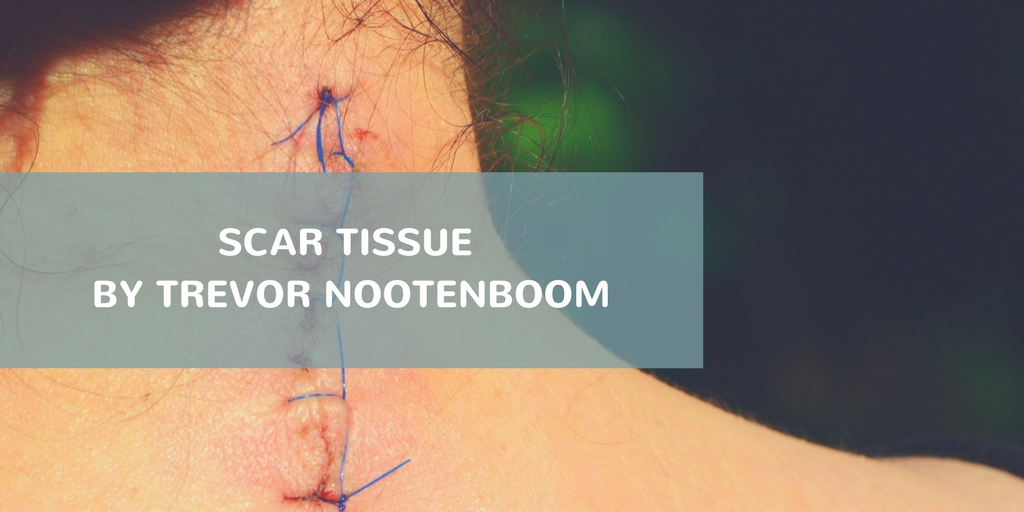 Scar Tissue Article Trevor Nootenboom